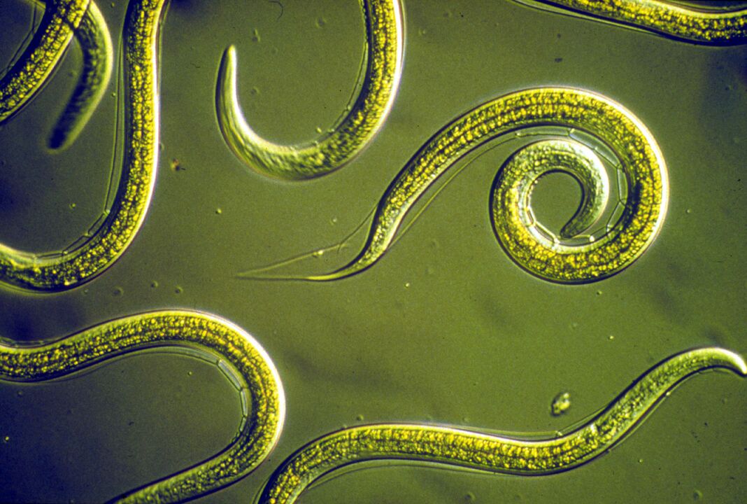 pinworm férgek az emberi testből